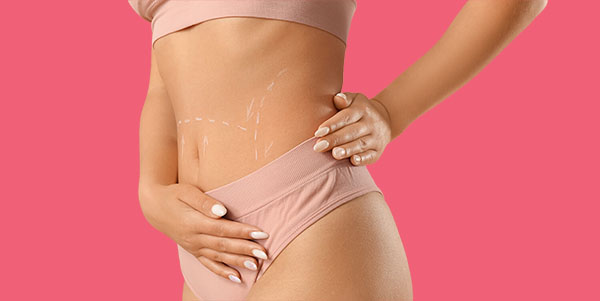 Liposuction- main