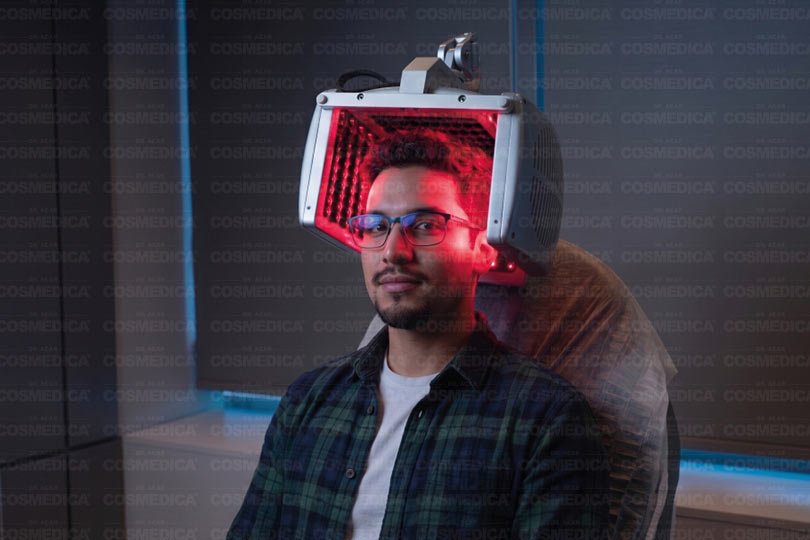 sac-lazer-tedavisi-3